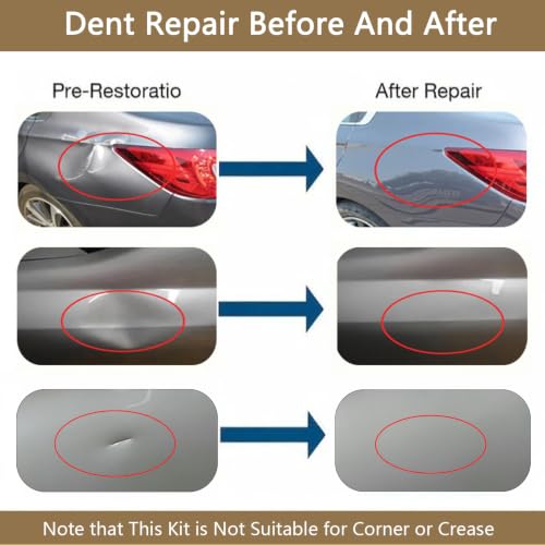 Paintless Dent Repair Kit Professional Auto Body Puller Tool - 8 Pack - size: Dent Puller Kit-8 Pack