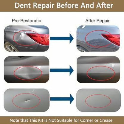 Paintless Dent Repair Kit Professional Auto Body Puller Tool - 8 Pack - size: Dent Puller Kit-8 Pack