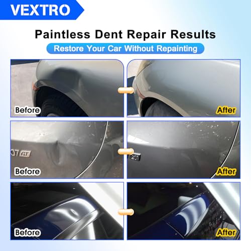 VEXTRO Paintless Dent Repair Kit, Car Dent Puller Kit for Auto Door Dents - size: PDR Kit-1